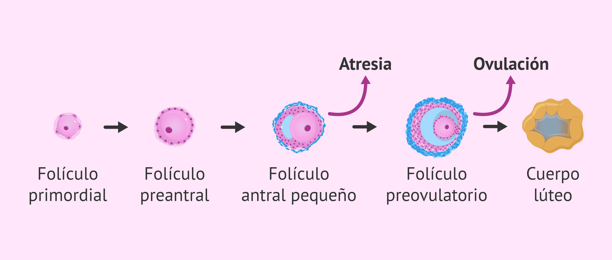 ¿Qué es la atresia folicular?