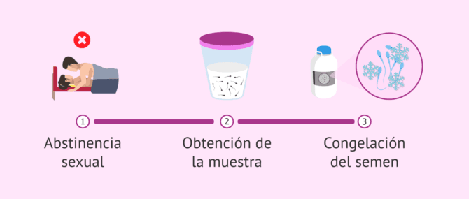 Imagen: Proceso para los donantes de semen