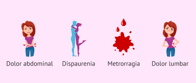 Imagen: Dolor en endometriosis