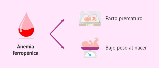 Imagen: Anemia ferropénica durante el embarazo