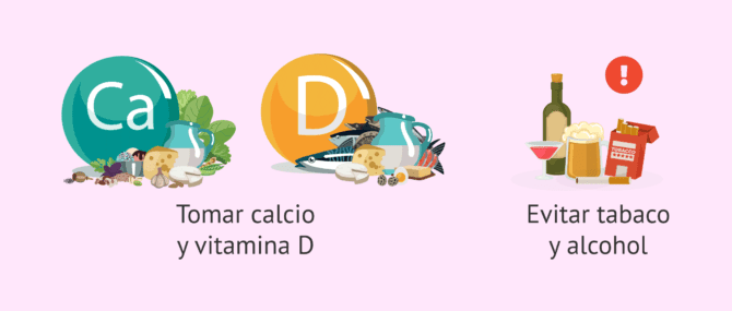 Imagen: Recomendaciones durante la inyección anticonceptiva para prevenir la osteoporosis