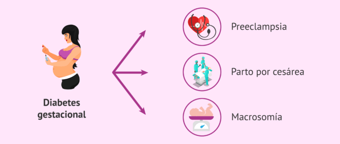 Imagen: Riesgos de la diabetes durante el embarazo