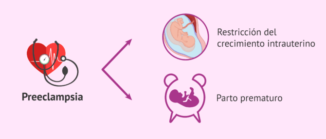 Imagen: Riesgos de la preeclampsia para el feto