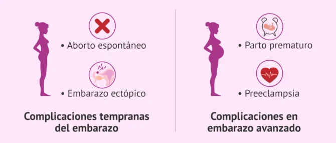 Imagen: Complicaciones del embarazo por endometriosis