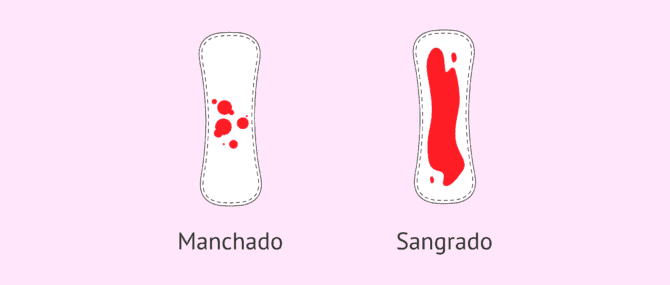Imagen: Sangrado en el embarazo