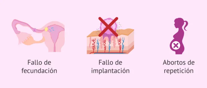 Imagen: ¿Cómo afectan los miomas a la fertilidad?