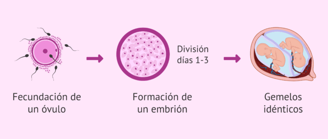 Imagen: ¿Qué es un embarazo gemelar?