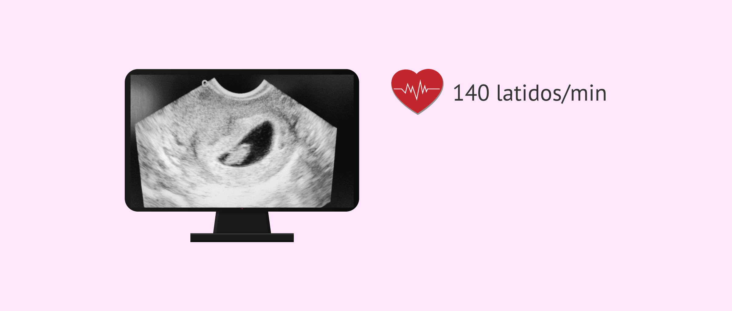 ¿Qué es el latido fetal?