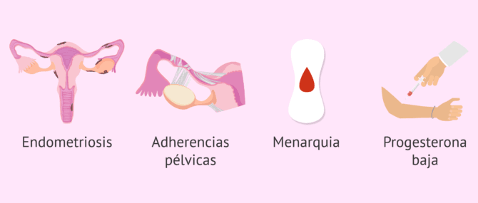 Imagen: polimenorrea-glosario