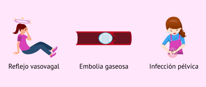 Imagen: ¿Qué peligros tiene la histeroscopia?