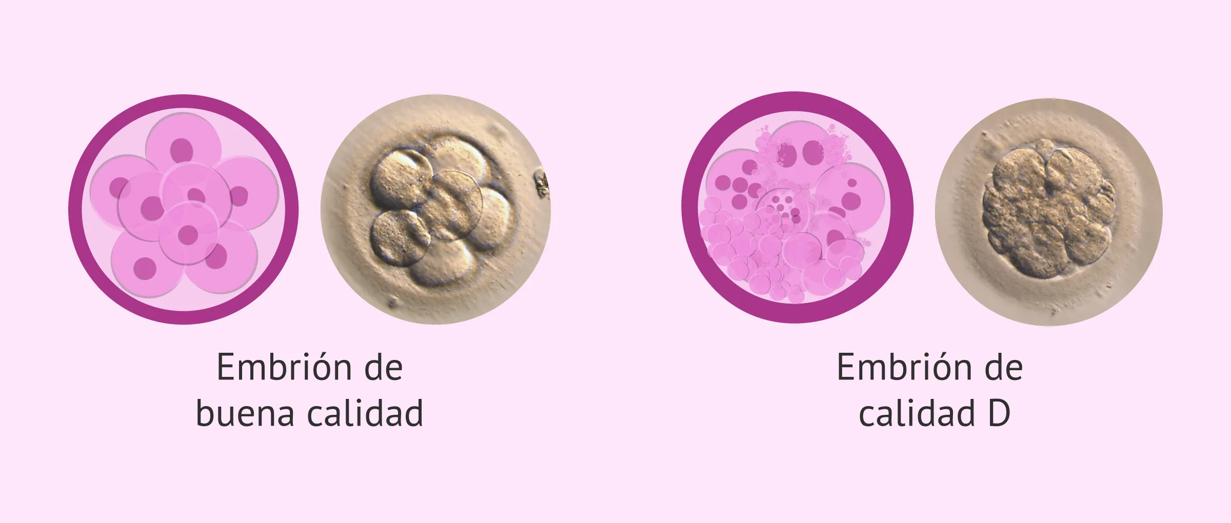 Imagen: Transferencia de embriones de calidad D:¿sí o no?