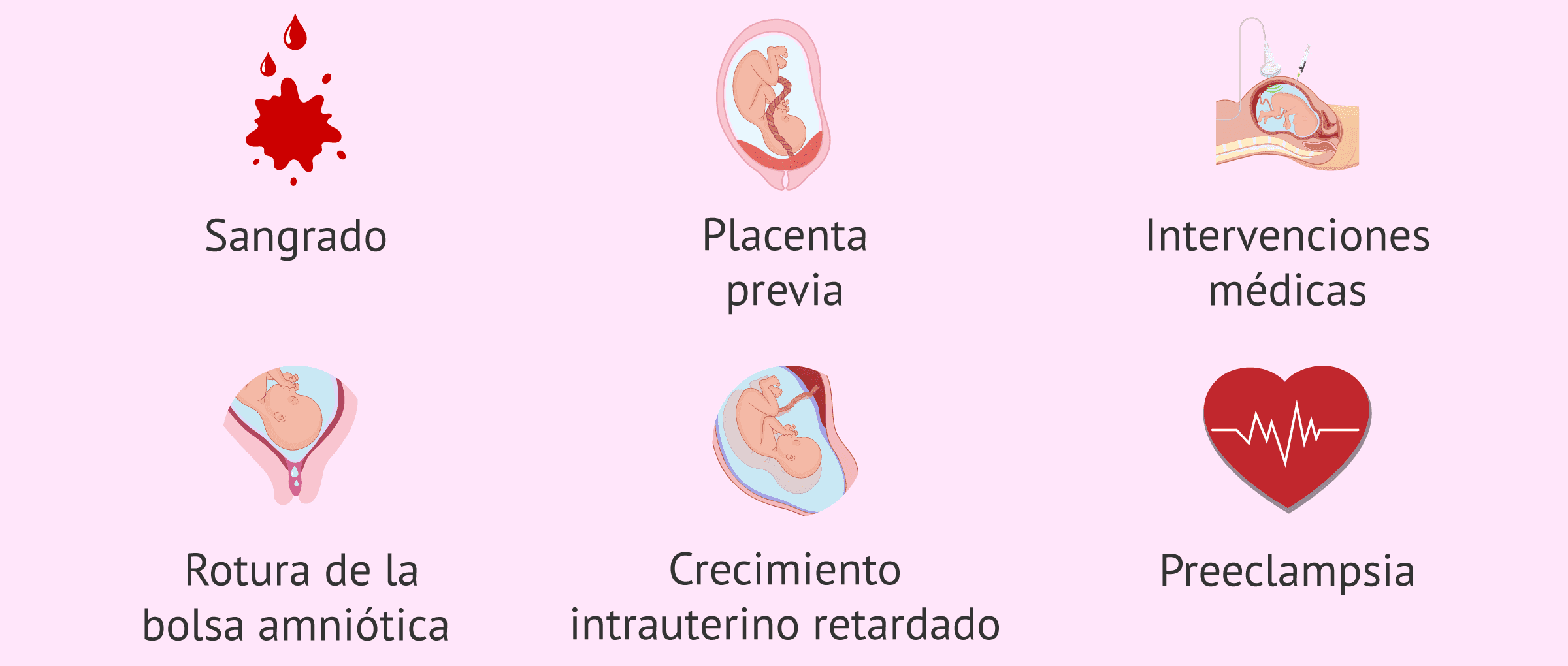 ¿Cuándo está indicado el reposo absoluto en el embarazo?