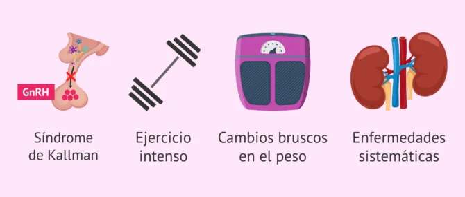 Imagen: Causas hipotalámicas-hipofisarias de la anovulación