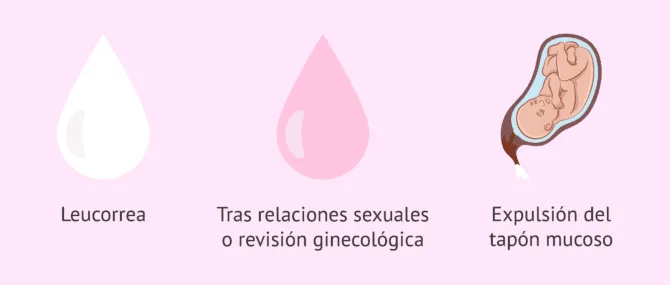 Es normal tener flujo vaginal? Para qu sirve y cundo es anormal?