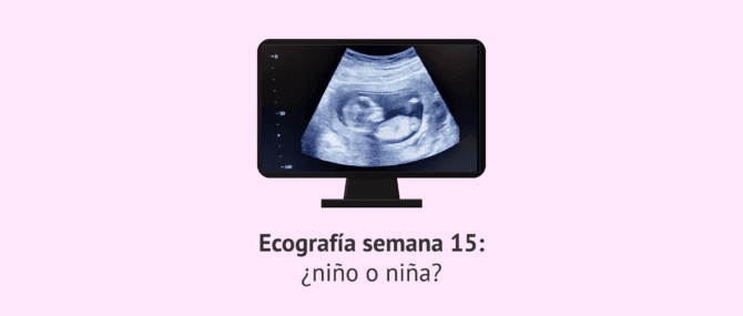 Imagen: Ecografía en la semana 15 de embarazo