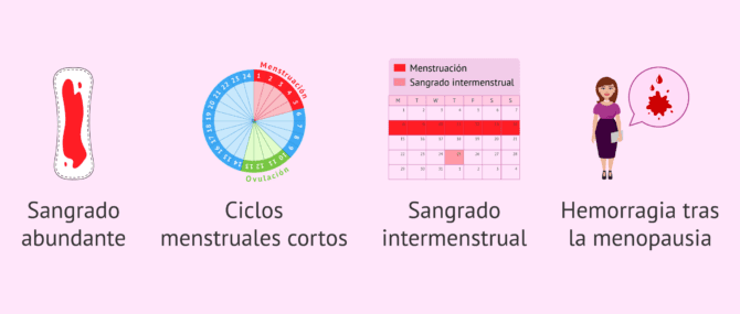 Imagen: ¿Qué síntomas produce la hiperplasia endometrial?