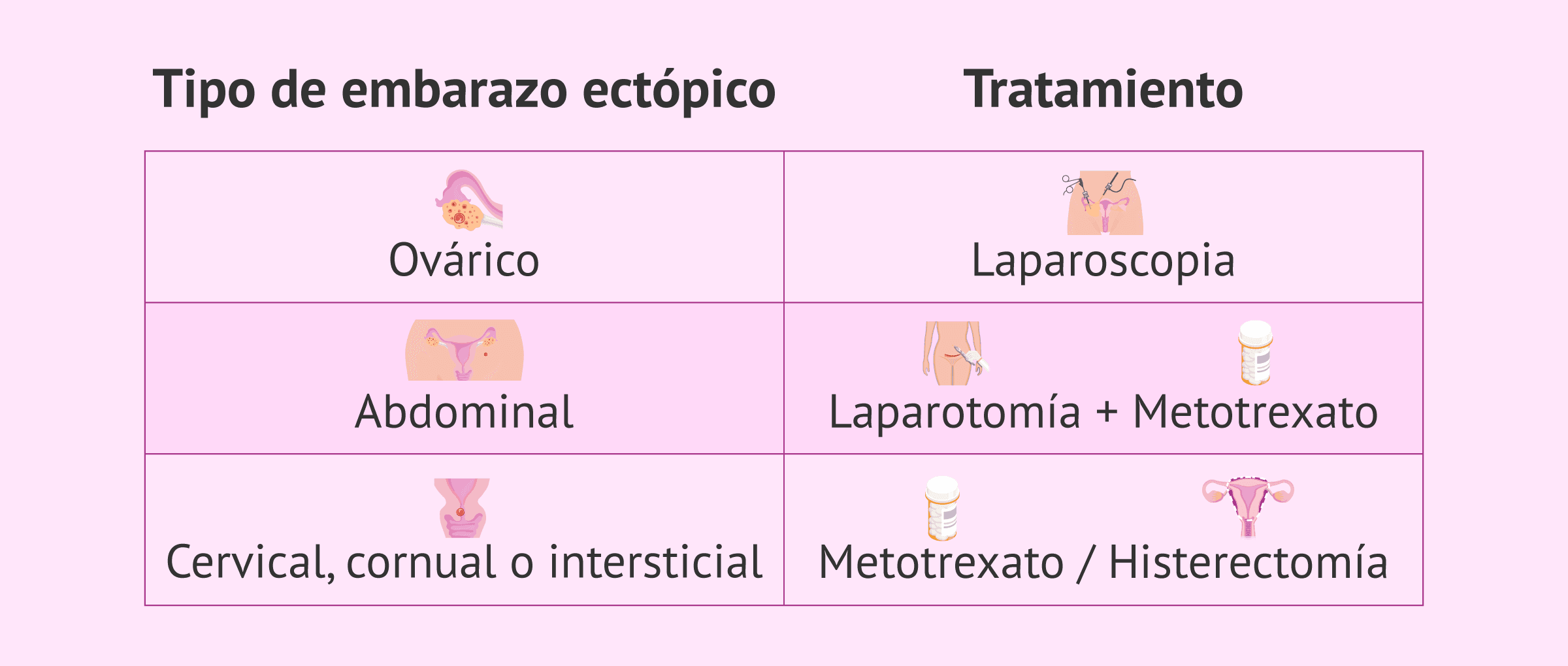 Imagen: Tratamiento según el tipo de embarazo ectópico