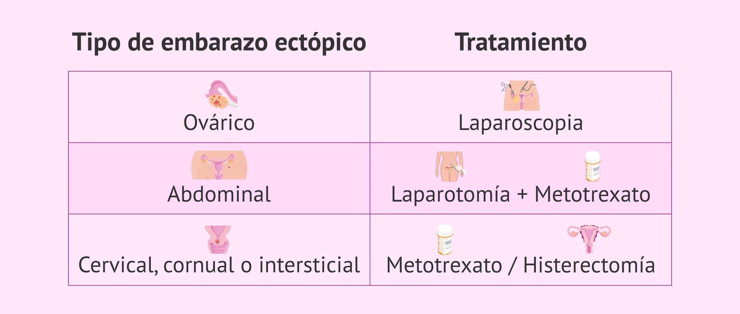 Tratamiento según el tipo de embarazo ectópico