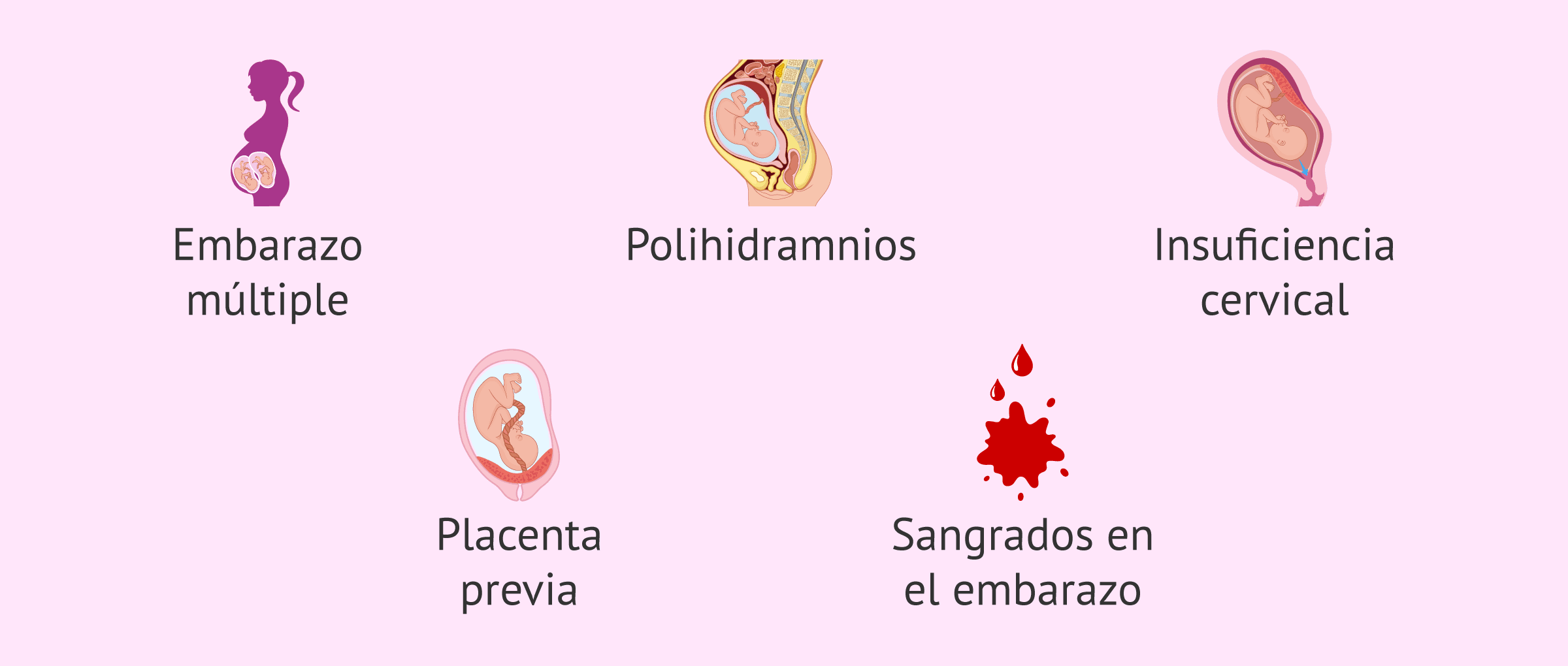 Imagen: Factores de riesgo durante el embarazo para el parto prematuro