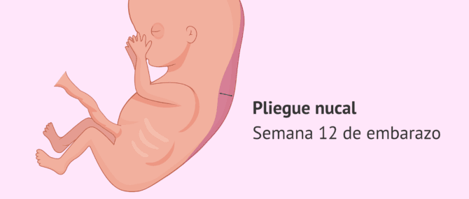 Imagen: pliegue-nucal-semana-12-glosario