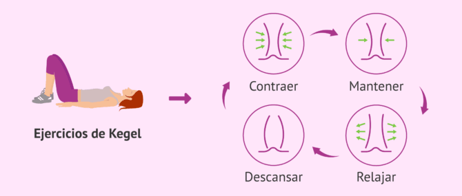 Imagen: ¿En qué consisten los ejercicios de Kegel?