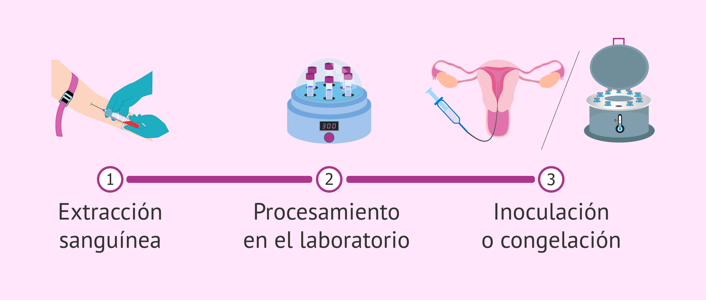 Usos del plasma rico en factores de crecimiento en reproducción asistida