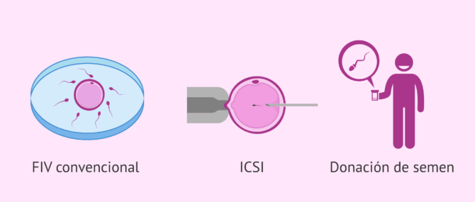 Imagen: Soluciones frente a la astenozoospermia para lograr el embarazo