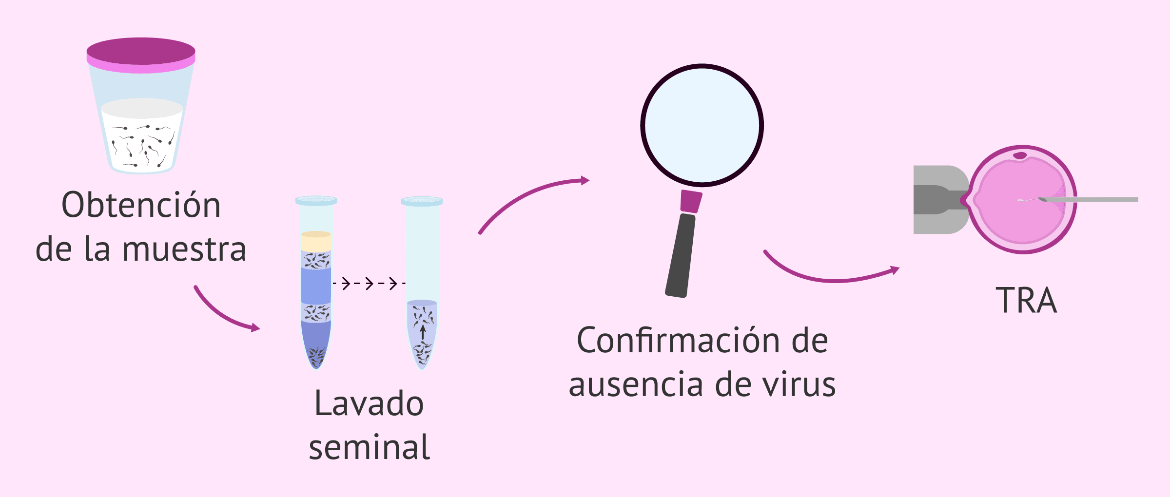 Lavado seminal para reproducción asistida en pacientes con VIH