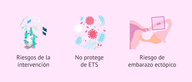 Imagen: Desventajas de la ligadura de trompas como método anticonceptivo permanente