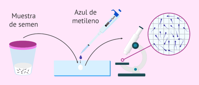 Imagen: ¿Cómo es el diagnóstico de la teratozoospermia?