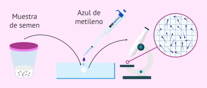 Imagen: ¿Cómo es el diagnóstico de la teratozoospermia?