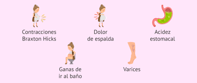 Imagen: ¿Qué síntomas hay en la semana 31 de gestación?