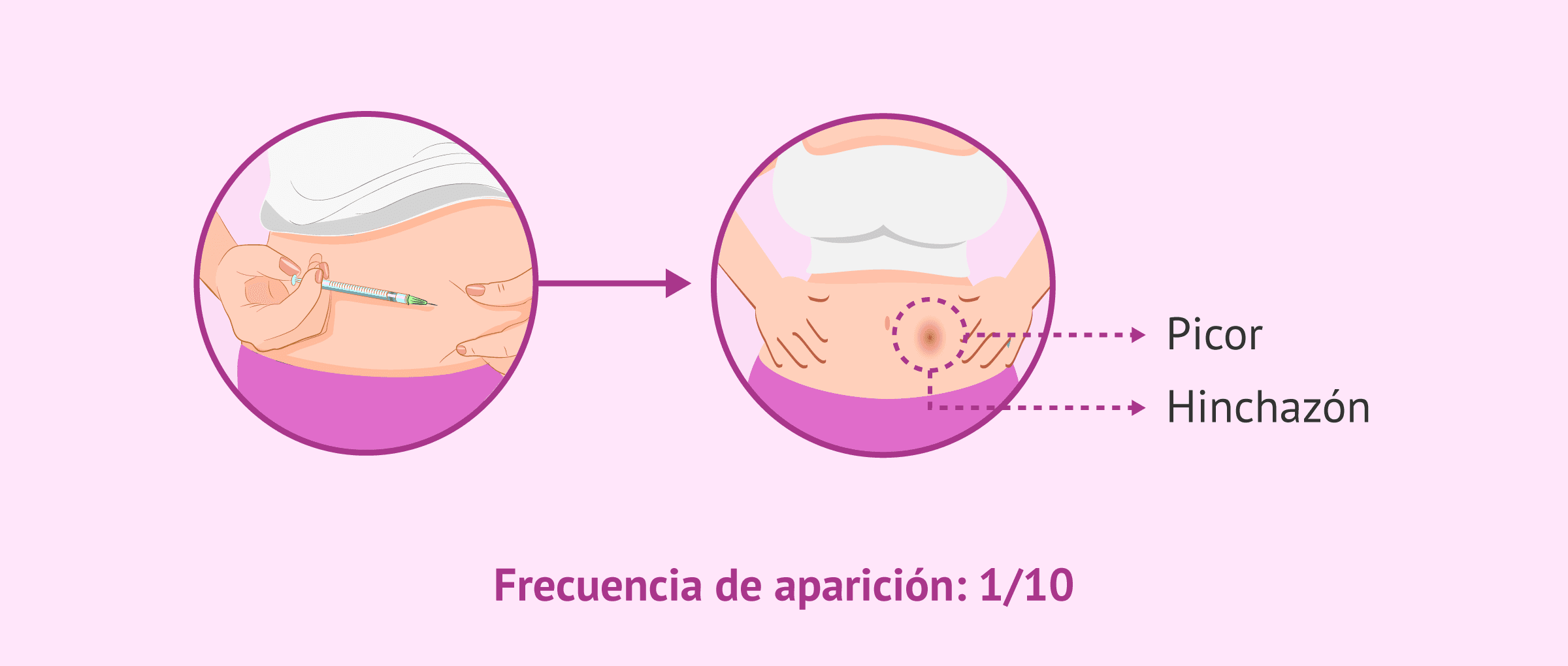Imagen: Efectos secundarios frecuentes del Orgalutran