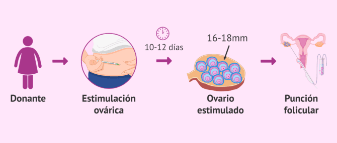 Imagen: Proceso de estimulación ovárica para la donante