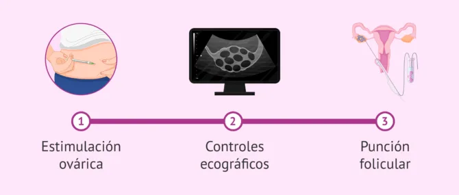 Imagen: ¿Por qué pasará la donante de óvulos?
