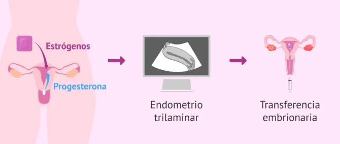 Imagen: Proceso para la receptora de óvulos