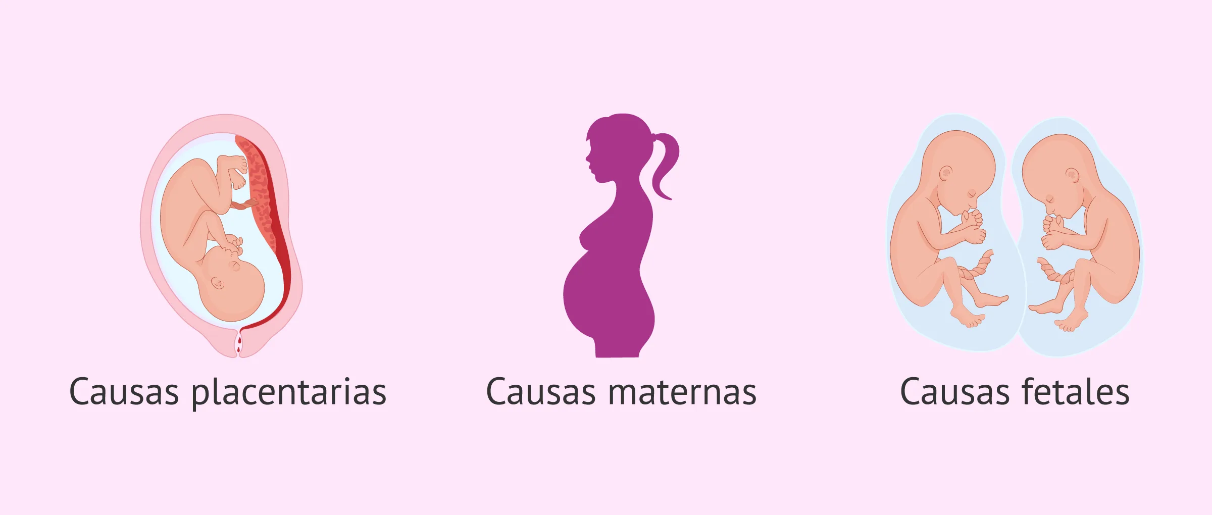 Imagen: Factores causantes CIUR