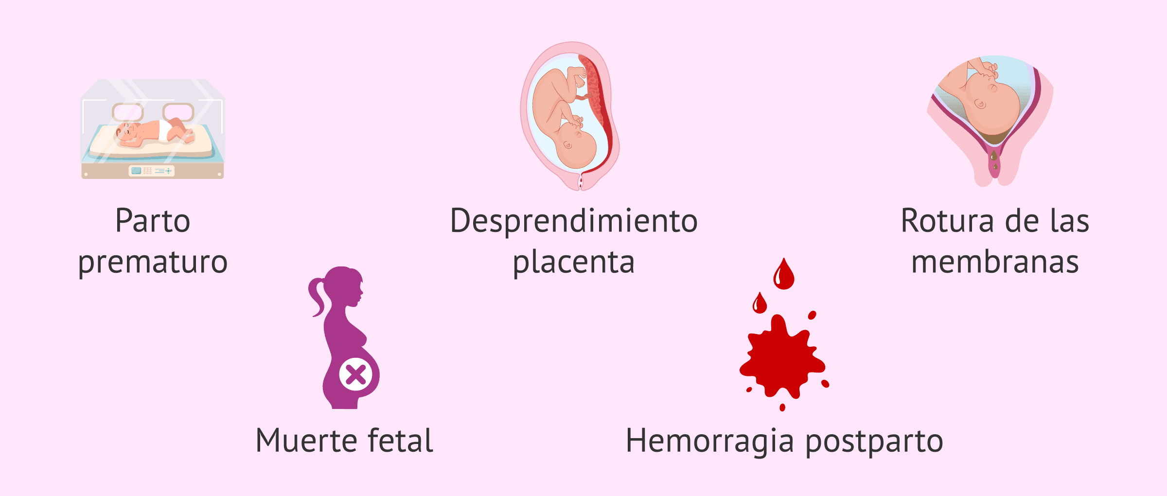 Imagen: ¿El polihidramnios provoca complicaciones?