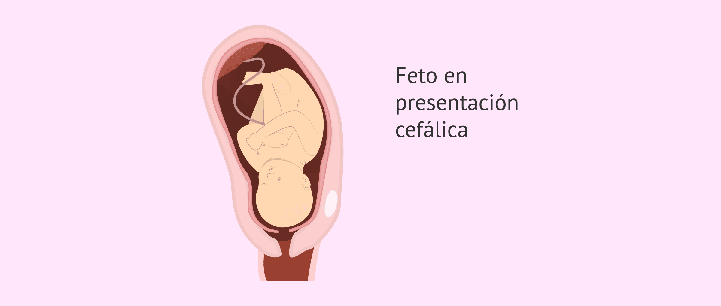 ¿Qué es la presentación cefálica?