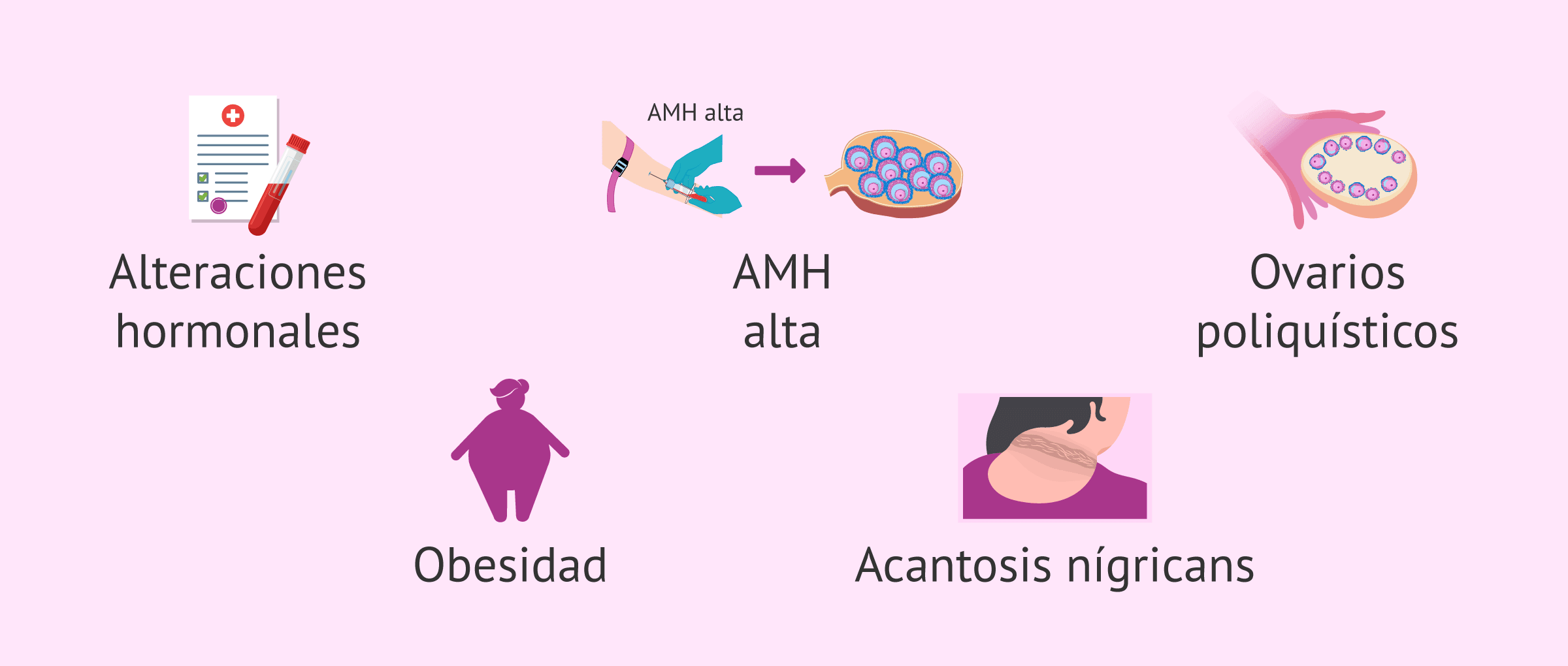 Imagen: Otros signos del SOP