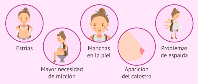 Imagen: Cambios en la madre en el sexto mes de gestación