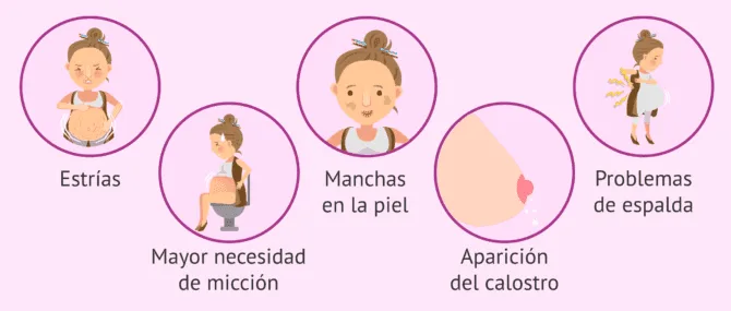 Imagen: Cambios en la madre en el sexto mes de gestación