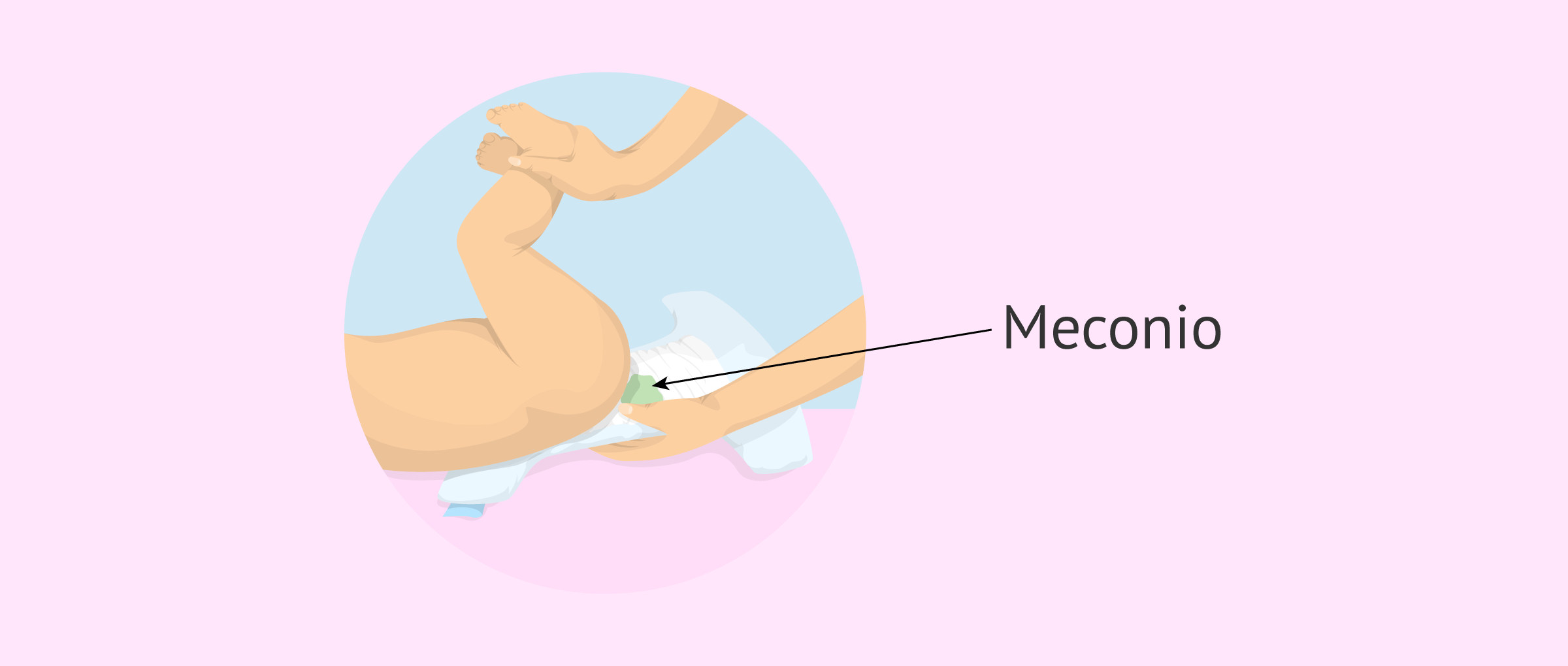 Imagen: Definición de meconio