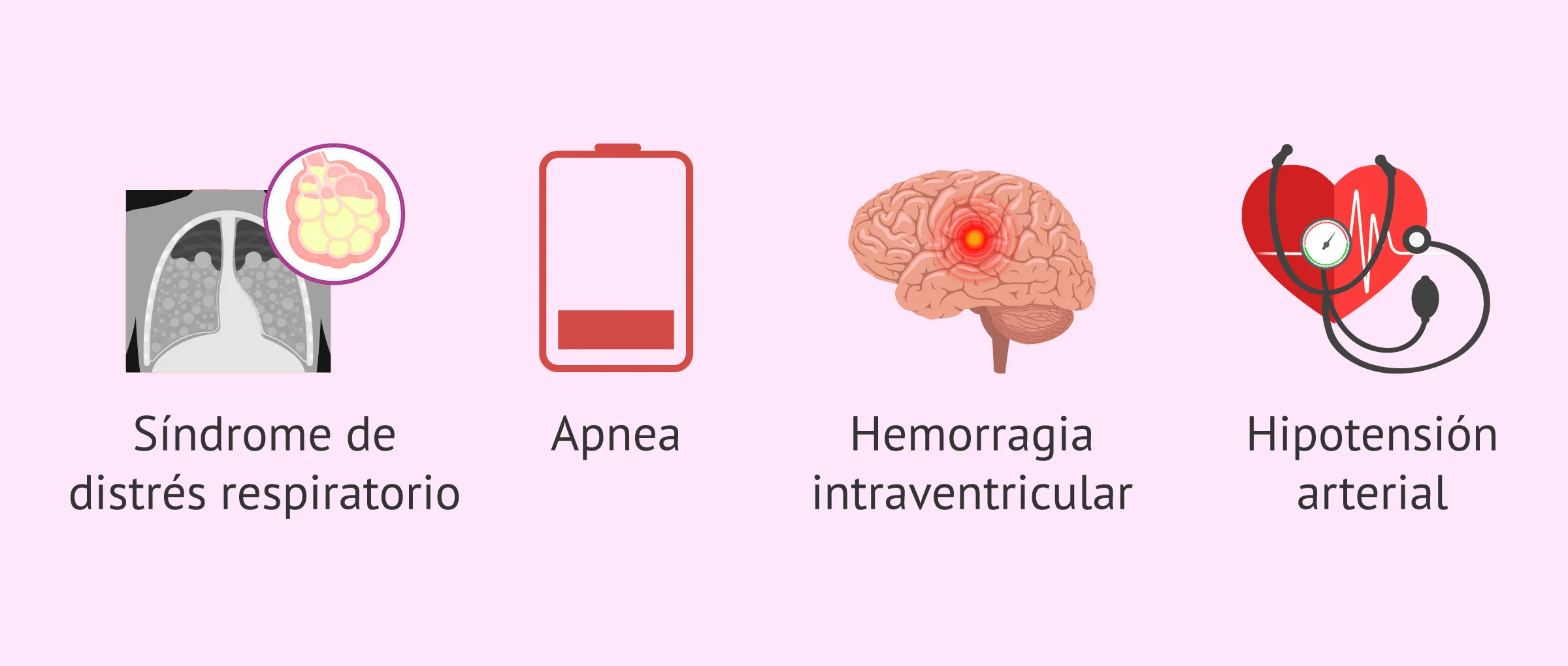 Complicaciones en los bebés prematuros