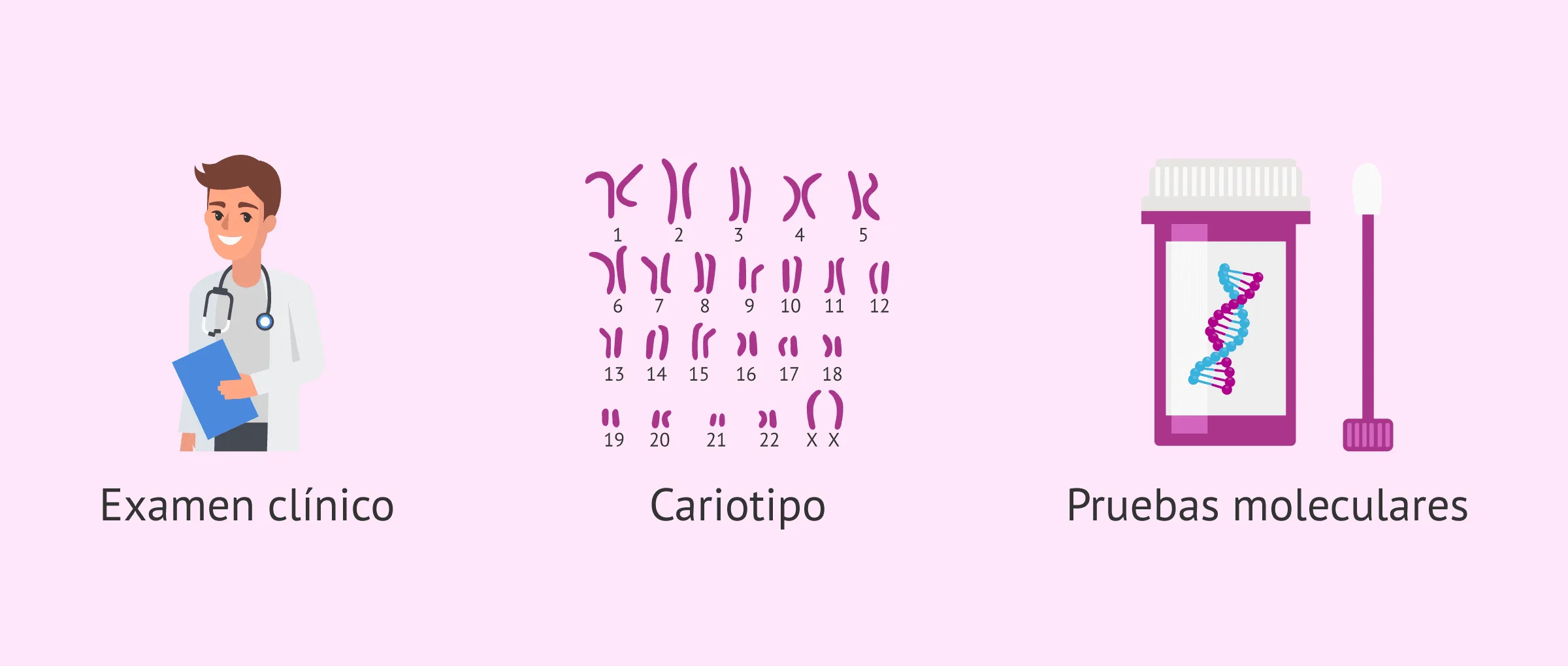 Imagen: Diagnóstico del Síndrome Beckwith Wiedemann SBW