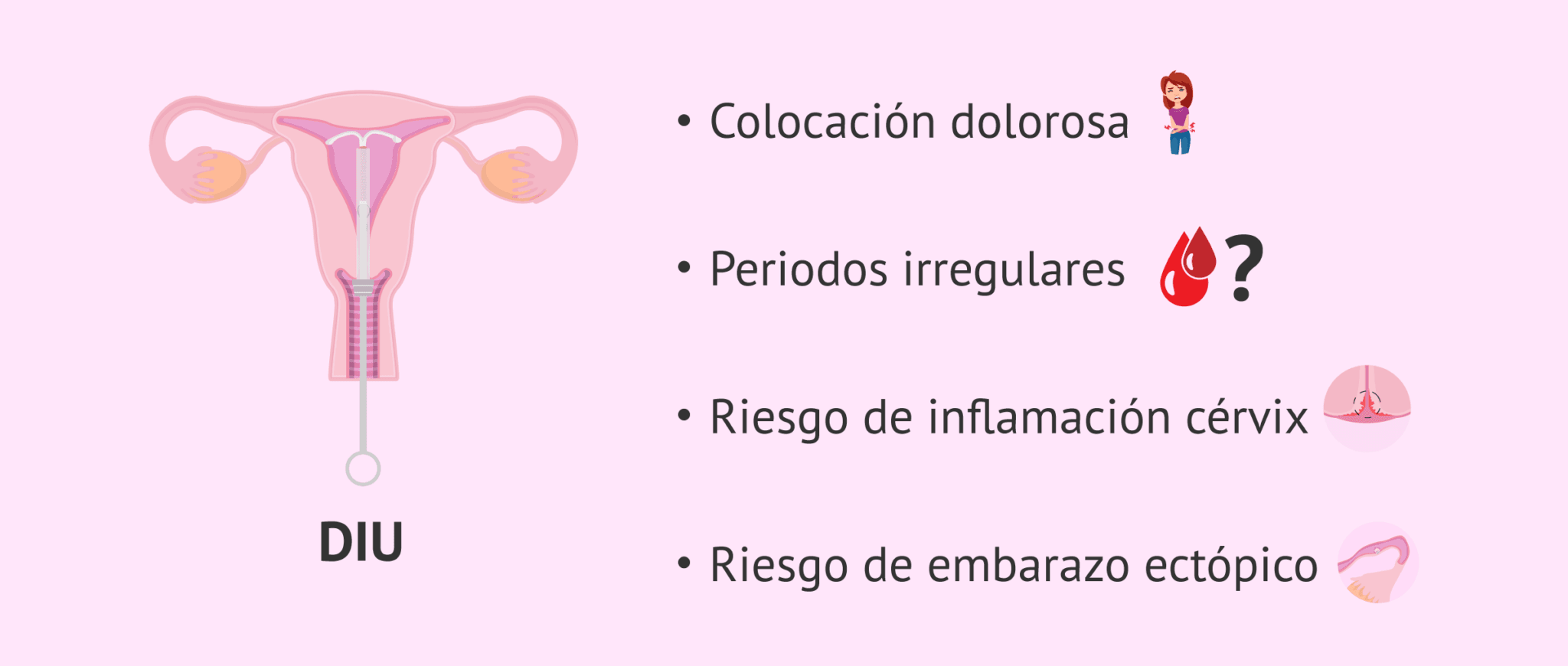 ¿Cuáles son los inconvenientes del DIU?