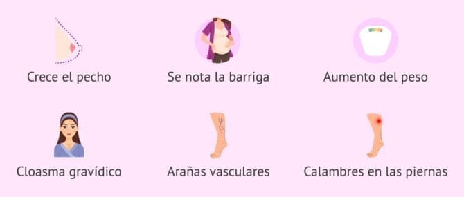 Imagen: Síntomas en el tercer mes de embarazo