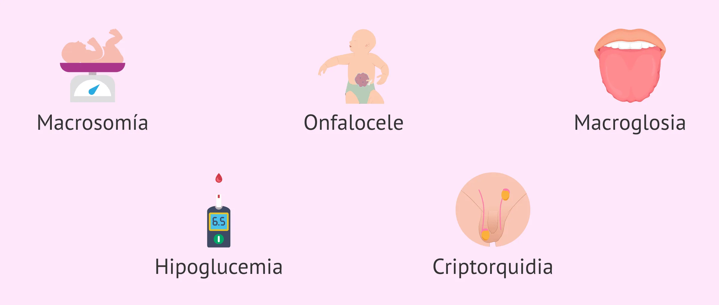 Imagen: Origen del SBW