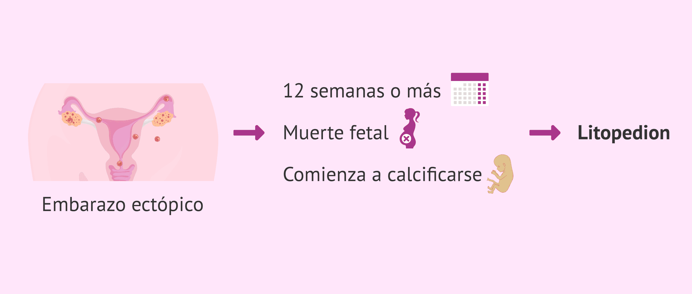 Imagen: Bebé de piedra