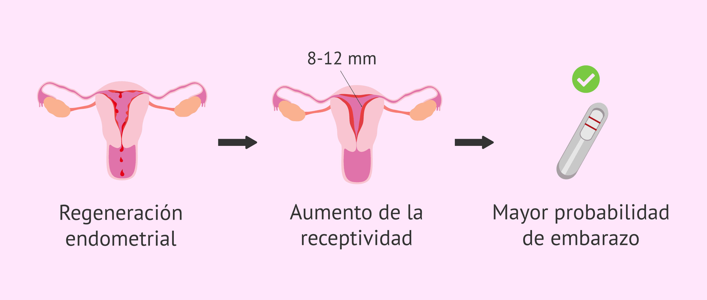 Imagen: Objetivos del raspado endometrial